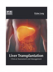 Liver Transplantation: Clinical Assessment And Management Hardcover