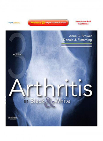 Arthritis In Black And White Hardcover 3