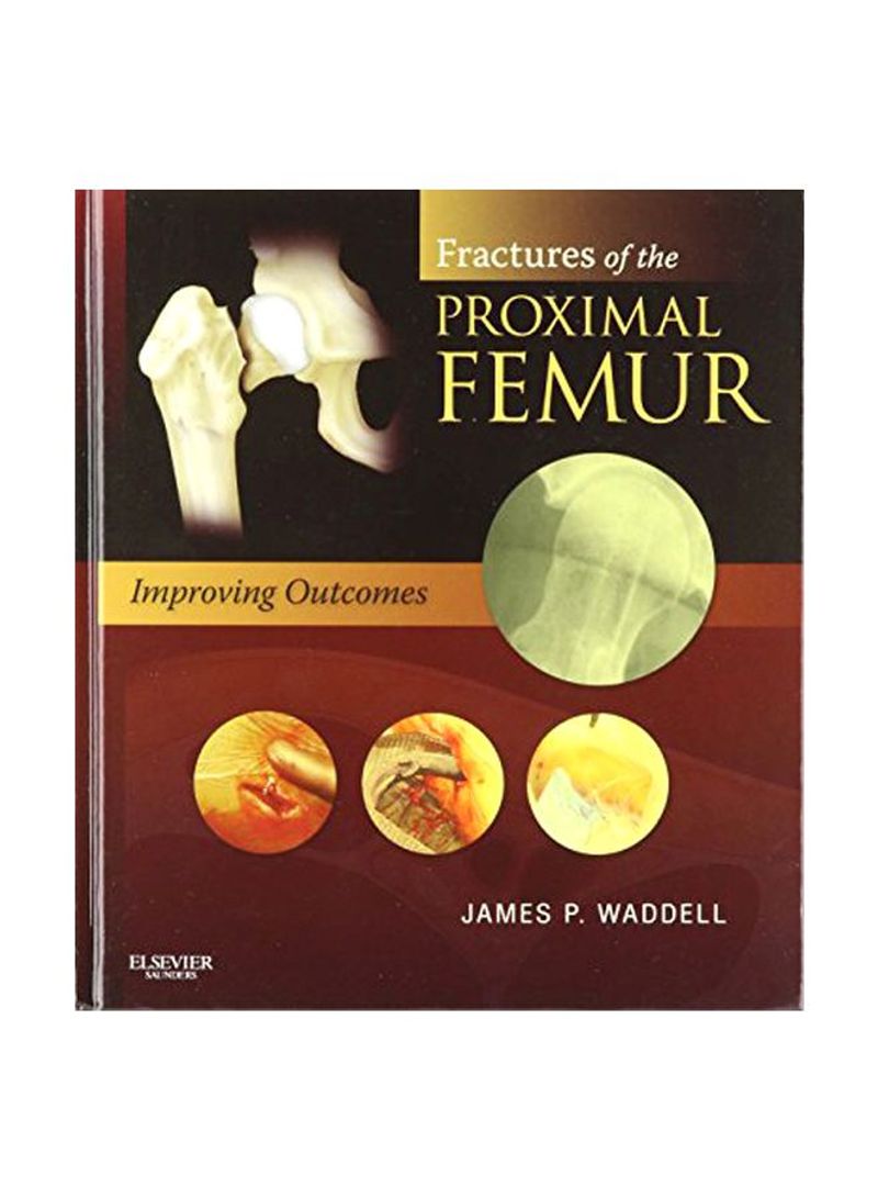 Fractures Of The Proximal Femur: Improving Outcomes Hardcover