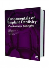 Fundamentals of Implant Dentistry: Prosthodontic Principles: 1 Hardcover English by John Beumer