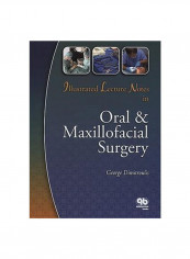 Illustrated Lecture Notes in Oral and Maxillofacial Surgery Hardcover 1st Edition