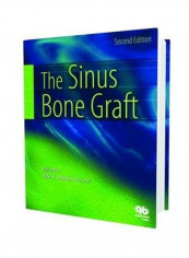 Sinus Bone Graft Hardcover English by Ole T. Jensen