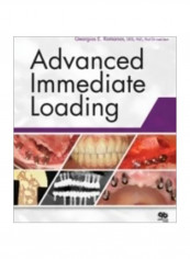 Advanced Immediate Loading Paperback