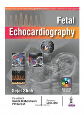 Fetal Echocardiography Paperback