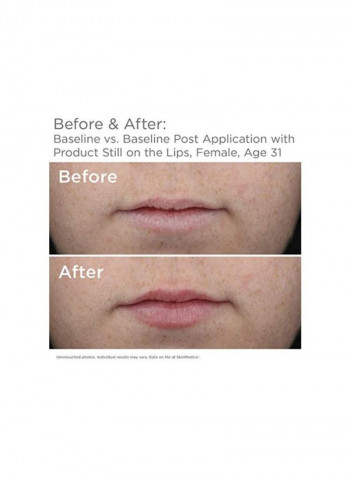 2-Piece HA5 Lip System Smooth And Plump Set Clear
