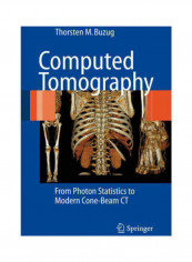 Computed Tomography: From Photon Statistics To Modern Cone-Beam CT Hardcover English by Thorsten M. Buzug reviews Computed Tomography: From Photon Statistics To Modern Cone-Beam CT Hardcover English by Thorsten M. Buzug