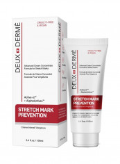 Stretch Mark Prevention 3.4ounce reviews Stretch Mark Prevention 3.4ounce