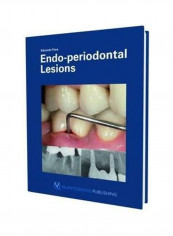 Endo-periodontal Lesion Hardcover English by Edoardo Foce