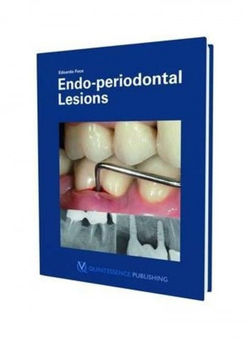 Endo-periodontal Lesion Hardcover English by Edoardo Foce