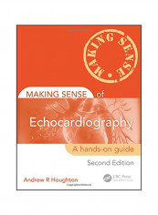 Making Sense Of Echocardiography Paperback 2 reviews Making Sense Of Echocardiography Paperback 2
