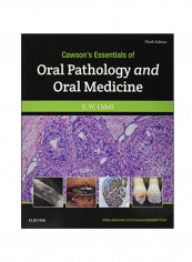 Cawson's Essentials Of Oral Pathology And Oral Medicine Paperback 9