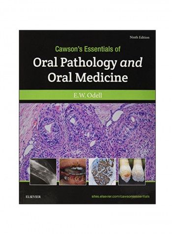 Cawson's Essentials Of Oral Pathology And Oral Medicine Paperback 9