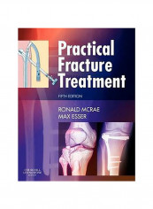 Practical Fracture Treatment Paperback
