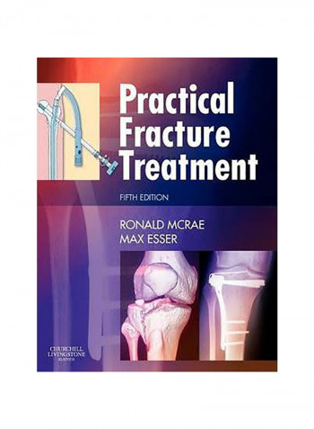 Practical Fracture Treatment Paperback