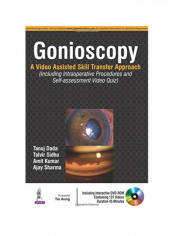 Gonioscopy Hardcover English by Tanuj Dada - 42461