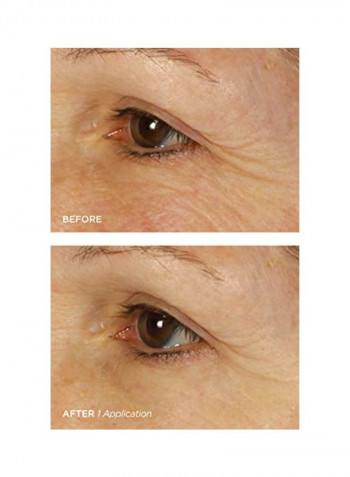 15-Piece Bright Eyes Collagen