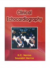 Clinical Echocardiography Hardcover reviews Clinical Echocardiography Hardcover
