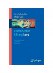 Frozen Section Library: Lung Paperback reviews Frozen Section Library: Lung Paperback