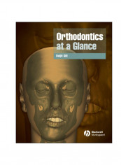 Orthodontics At A Glance Paperback