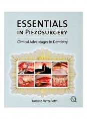 Essentials In Piezosurgery: Clinical Advantages In Dentistry Paperback