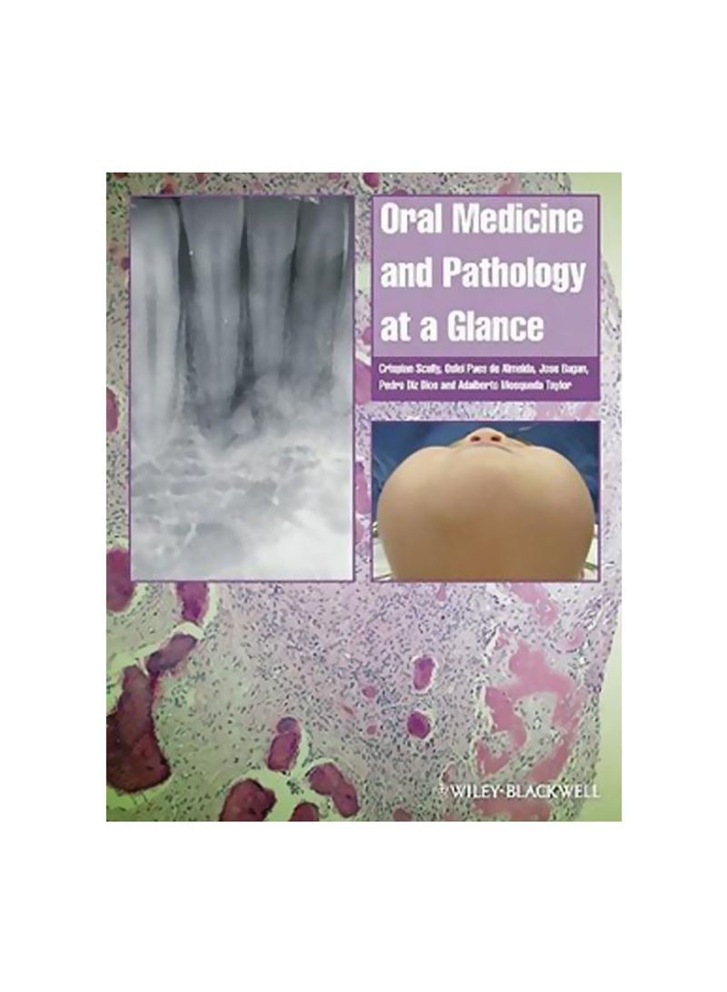 Oral Medicine And Pathology At A Glance Paperback