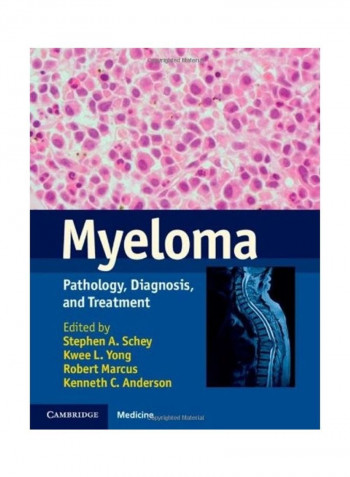 Myeloma Hardcover English by Stephen A. Schey reviews Myeloma Hardcover English by Stephen A. Schey