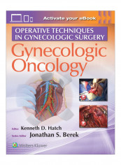 Gynecologic Oncology Hardcover 1st edition
