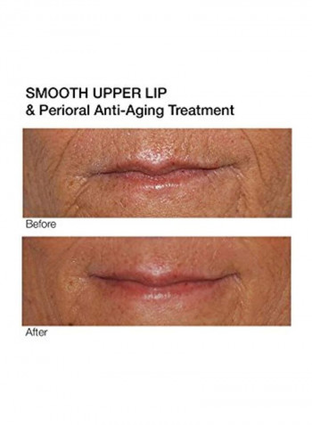 Upper Lip And Perioral Anti-Aging Treatment 0.5ounce