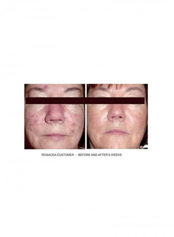 Pore Minimizing Daily Facial Cleanser 4ounce