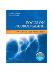 Focus On Neuroimaging Paperback