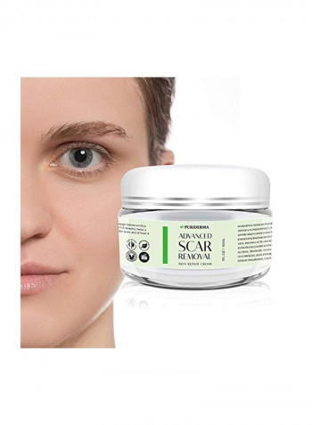 Advanced Scar Removal Skin Repair Cream 30ml