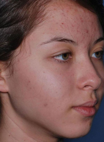 منظف رغوي للعناية اليومية من Clenziderm M.D 118مل