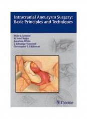 Intracranial Aneurysm Surgery Paperback English by Duke Samson