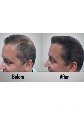 Hair Growth Trigger 180ml