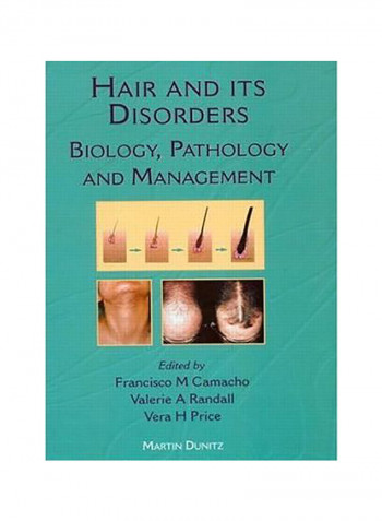 Hair And Its Disorders Hardcover