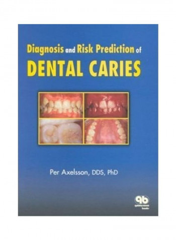 Diagnosis And Risk Predication Of Dental Caries Hardcover English by Per Axelsson